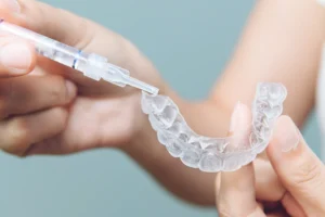 Invisalign Warszawa